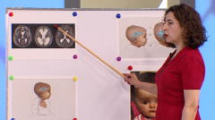 First Aid: Hydrocephalus, Neurosis