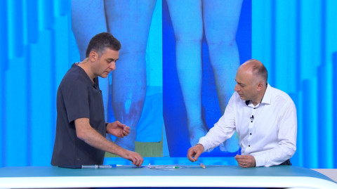 Be Healthy! Varicose Veins